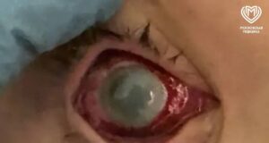 Московские школьники едва не лишились зрения из-за эксперимента из интернета.