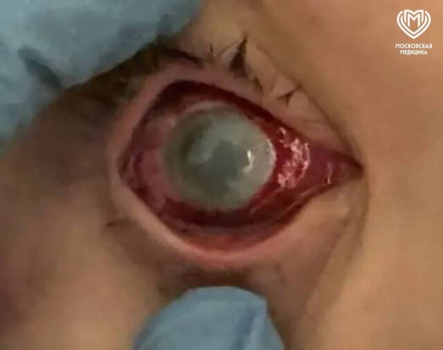 Московские школьники едва не лишились зрения из-за эксперимента из интернета.