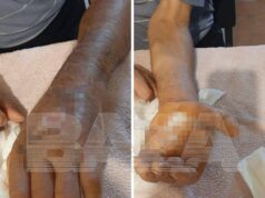 Агрессивный жеребец напал на работника белгородской конюшни и заразил его опасной инфекцией