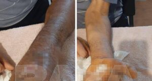 Агрессивный жеребец напал на работника белгородской конюшни и заразил его опасной инфекцией