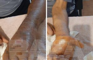 Агрессивный жеребец напал на работника белгородской конюшни и заразил его опасной инфекцией