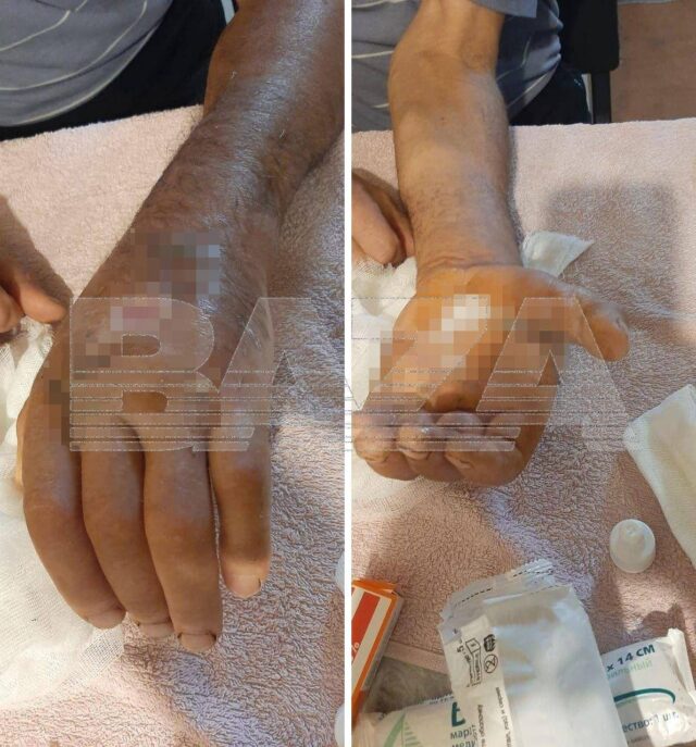 Агрессивный жеребец напал на работника белгородской конюшни и заразил его опасной инфекцией