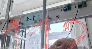 Бактерии начали разъедать москвичу сердце после визита к стоматологу.