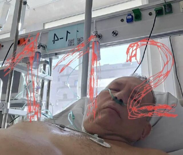 Бактерии начали разъедать москвичу сердце после визита к стоматологу.