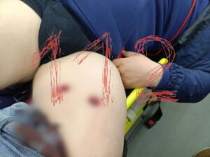 Полицейский открыл огонь по водолазу после конфликта в кафе Ленинградской области.