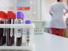 Пробирки с кровью - РИА Новости, 1920, 16.04.2026