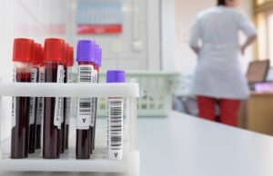 Пробирки с кровью - РИА Новости, 1920, 16.04.2026