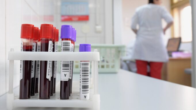 Пробирки с кровью - РИА Новости, 1920, 16.04.2026