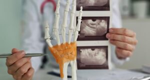 Врач показывает ультразвуковые снимки кисти руки - РИА Новости, 1920, 07.04.2026