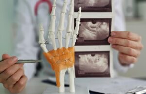 Врач показывает ультразвуковые снимки кисти руки - РИА Новости, 1920, 07.04.2026