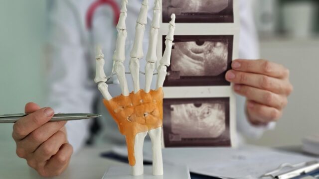 Стеклянную иглу, вросшую в руку женщины, нашли и извлекли врачи в Приморье Врач показывает ультразвуковые снимки кисти руки - РИА Новости, 1920, 07.04.2026