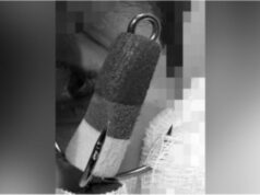 Крючок, который офтальмологи Центр Рошаля достались из глаза мальчика - РИА Новости, 1920, 22.04.2026