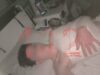 Один из пострадавших при обрушении балкона в севастопольской школе вышел на связь. Один из пострадавших при обрушении балкона в севастопольской школе вышел на связь.