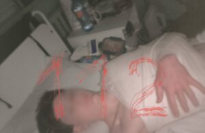 Один из пострадавших при обрушении балкона в севастопольской школе вышел на связь.