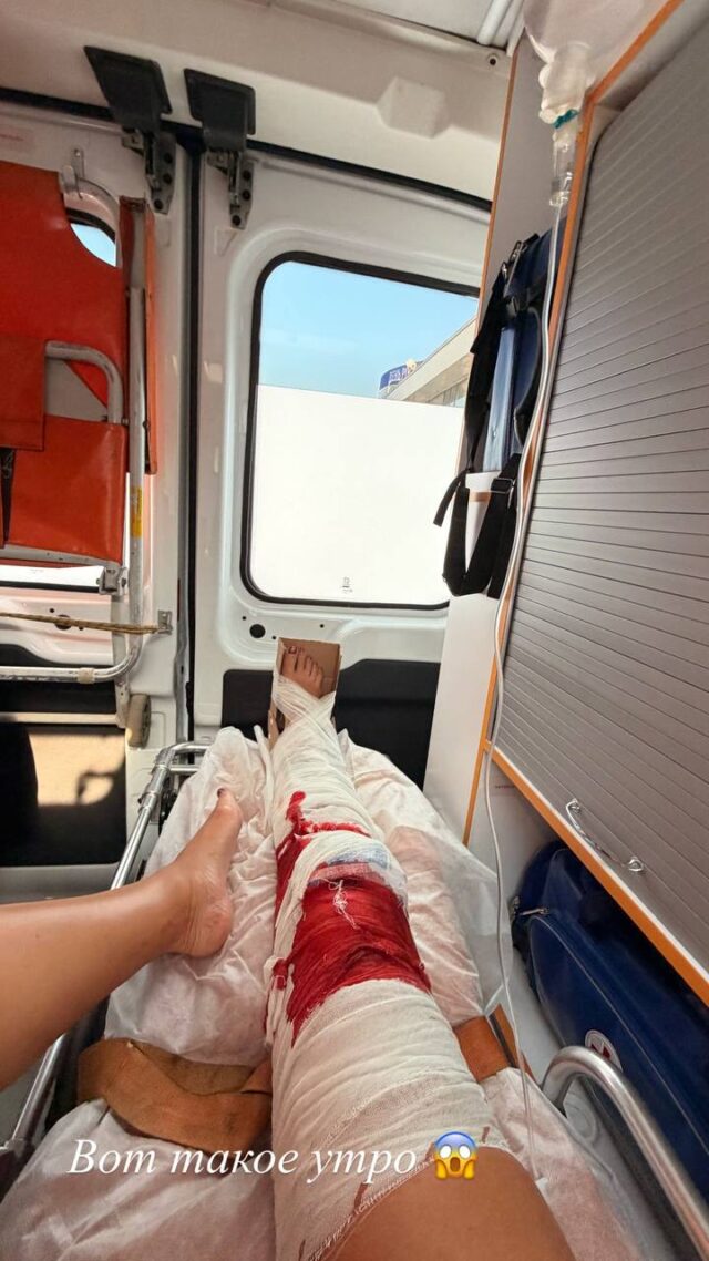 Ольга Бузова поделилась кадрами из машины скорой помощи. На фото видна окровавленная коленка. Ольга Бузова поделилась кадрами из машины скорой помощи. На фото видна окровавленная коленка.