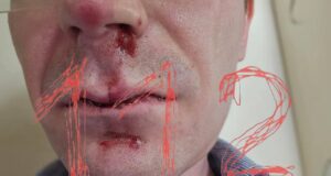 Подростки с цепями и металлическими прутьями избили мужчин в Перми.
