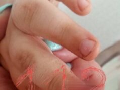 Воспитатель прищемил палец ребёнку в детском саду в Саратовской области и не оказал ему первую помощ