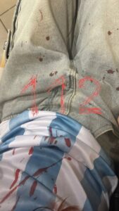 Ярый фанат Роналду Испании сломал девушке нос из-за футболки с Месси в рязанском баре. публикует ка