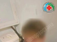 Секатор вонзился в лицо 14-летнему подростку во время игры с братом в Башкирии. Секатор вонзился в лицо 14-летнему подростку во время игры с братом в Башкирии.