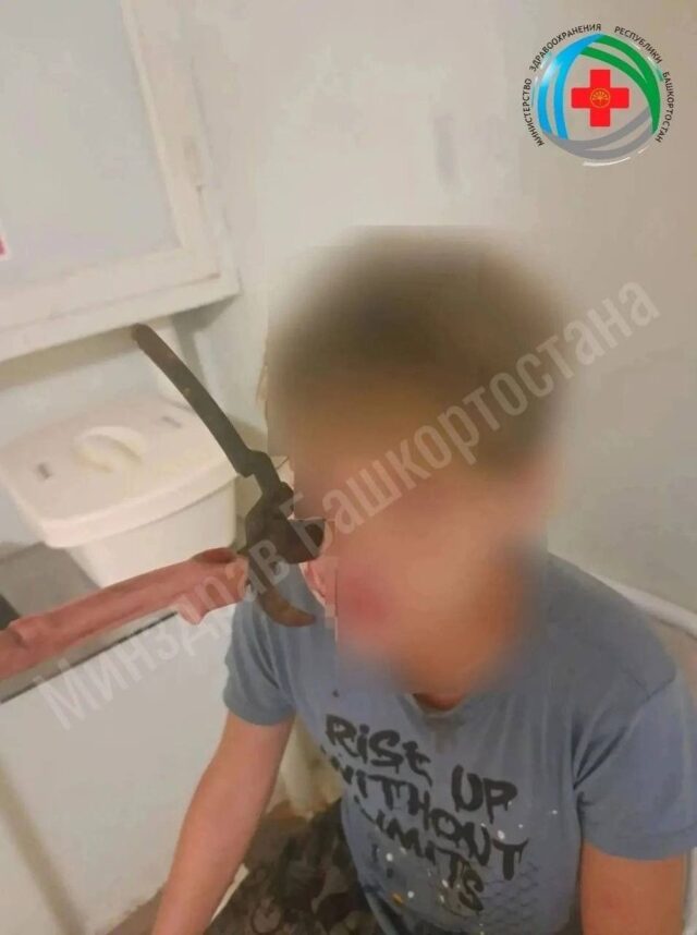 Секатор вонзился в лицо 14-летнему подростку во время игры с братом в Башкирии. Секатор вонзился в лицо 14-летнему подростку во время игры с братом в Башкирии.
