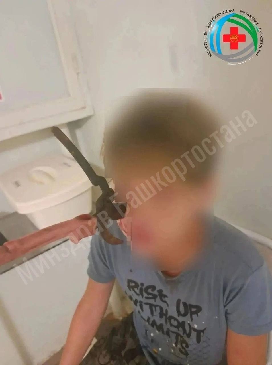 Секатор вонзился в лицо 14-летнему подростку во время игры с братом в Башкирии. Секатор вонзился в лицо 14-летнему подростку во время игры с братом в Башкирии.