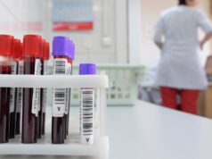 У трех жителей Липецка выявили лихорадку Западного Нила Пробирки с кровью - РИА Новости, 1920, 30.08.2026